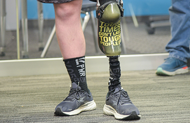  Austin Beatty leg